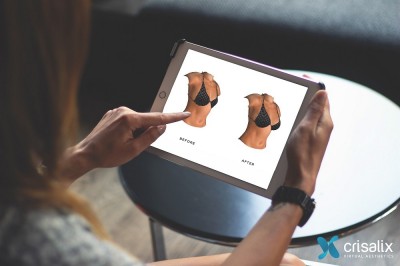 Virtual Reality Technology is Being Used to Allow Women to Preview Their Surgery before Going under the Knife