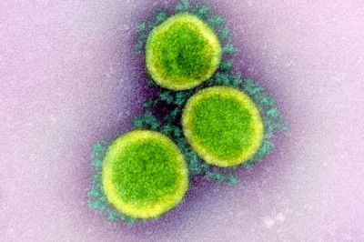 John Hopkins University: Q+A HOW LONG CAN THE VIRUS THAT CAUSES COVID-19 LIVE ON SURFACES?