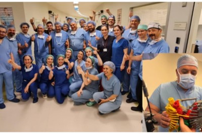 فريق طبي تركي يفصل توأمين ملتصقين في غضون تسع ساعات محطماً الرقم القياسي العالمي